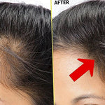 Spopo-oil.  زيت تساقط الشعرطبيعي %100